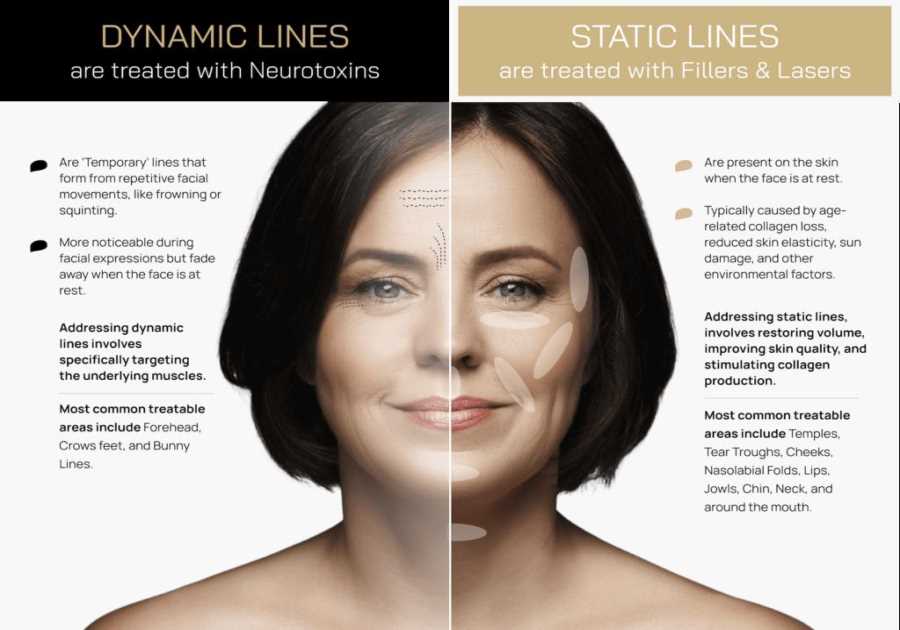 Neurotoxins, Fillers & Lasers: Effective Solutions for Fine Lines